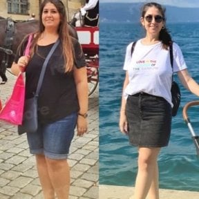 Before and after endoscopic sleeve gastroplasty results at Memorial Ataşehir Hospital