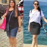 Before and after endoscopic sleeve gastroplasty results at Memorial Ataşehir Hospital