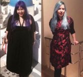 Endoscopic sleeve gastroplasty before and after results at Memorial Ataşehir Hospital, weight loss