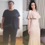 Endoscopic sleeve gastroplasty before and after results at Memorial Ataşehir Hospital