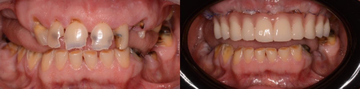 Стоматологическая клиника HALDENT