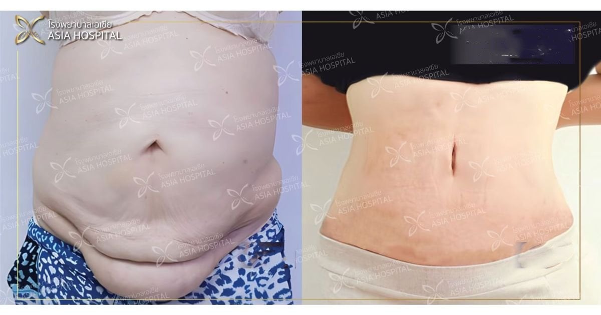 Клиника Asia Cosmetic (Asia Cosmetic Hospital)