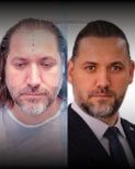 Résultats avant et après greffe de cheveux DHI chez Men's Health Clinics, ligne améliorée
