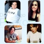 Résultats avant/après sleeve gastrique au Dr Rodrigo Prieto Bariatric Center, Mexique