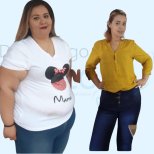 Vorher-nachher-Ergebnisse Roux-en-Y-Magenbypass bei Dr. Rodrigo Prieto Bariatric Center