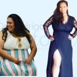 Результат до і після гастрошунтування в Dr. Rodrigo Prieto Bariatric Center Мексика