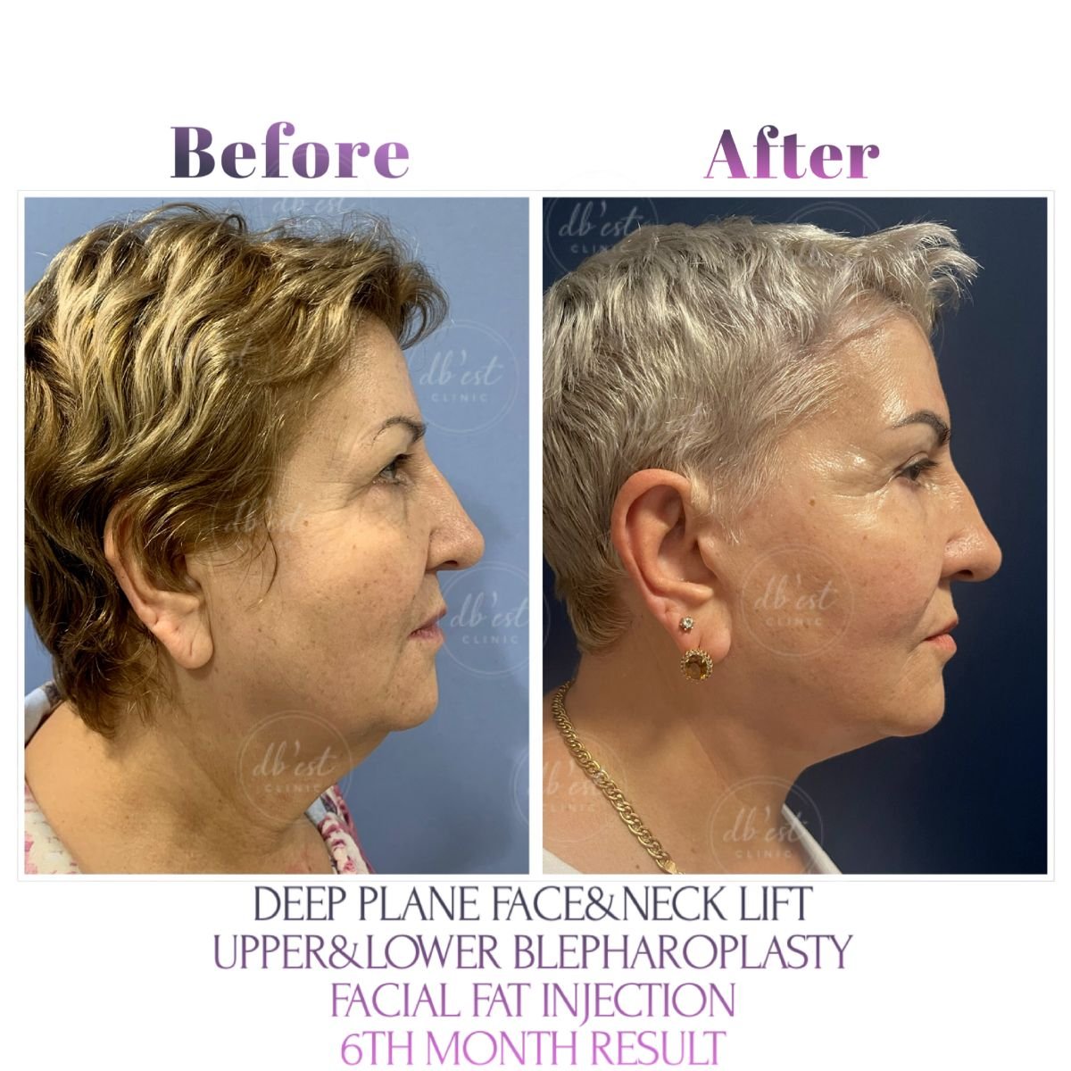 Clínica de Cirugía Plástica Estética y Reconstructiva Db'est Clinic