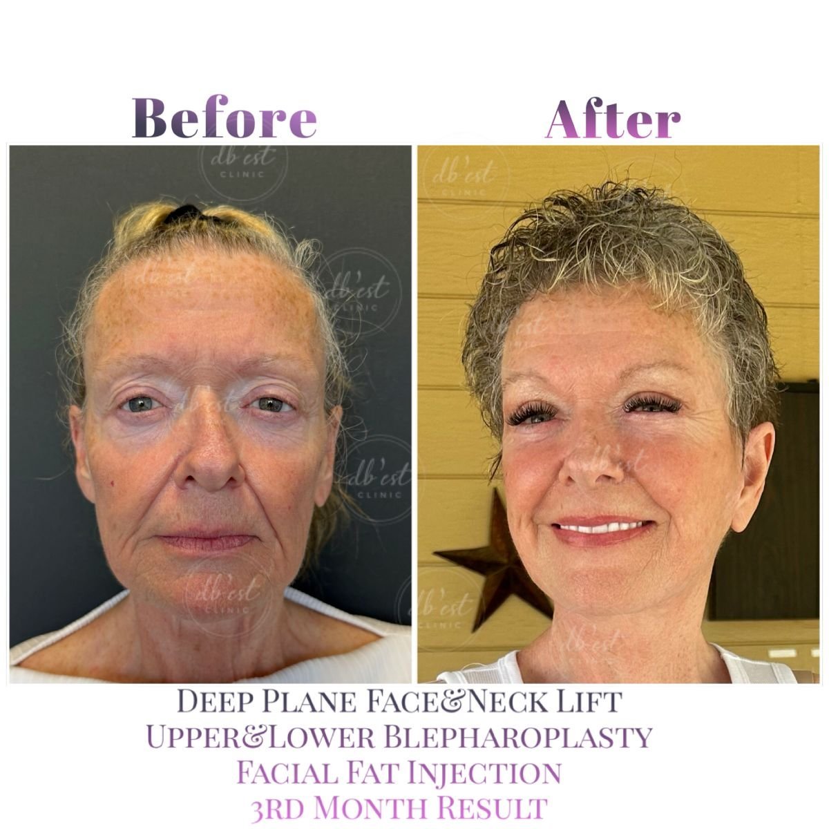 Clínica de Cirugía Plástica Estética y Reconstructiva Db'est Clinic