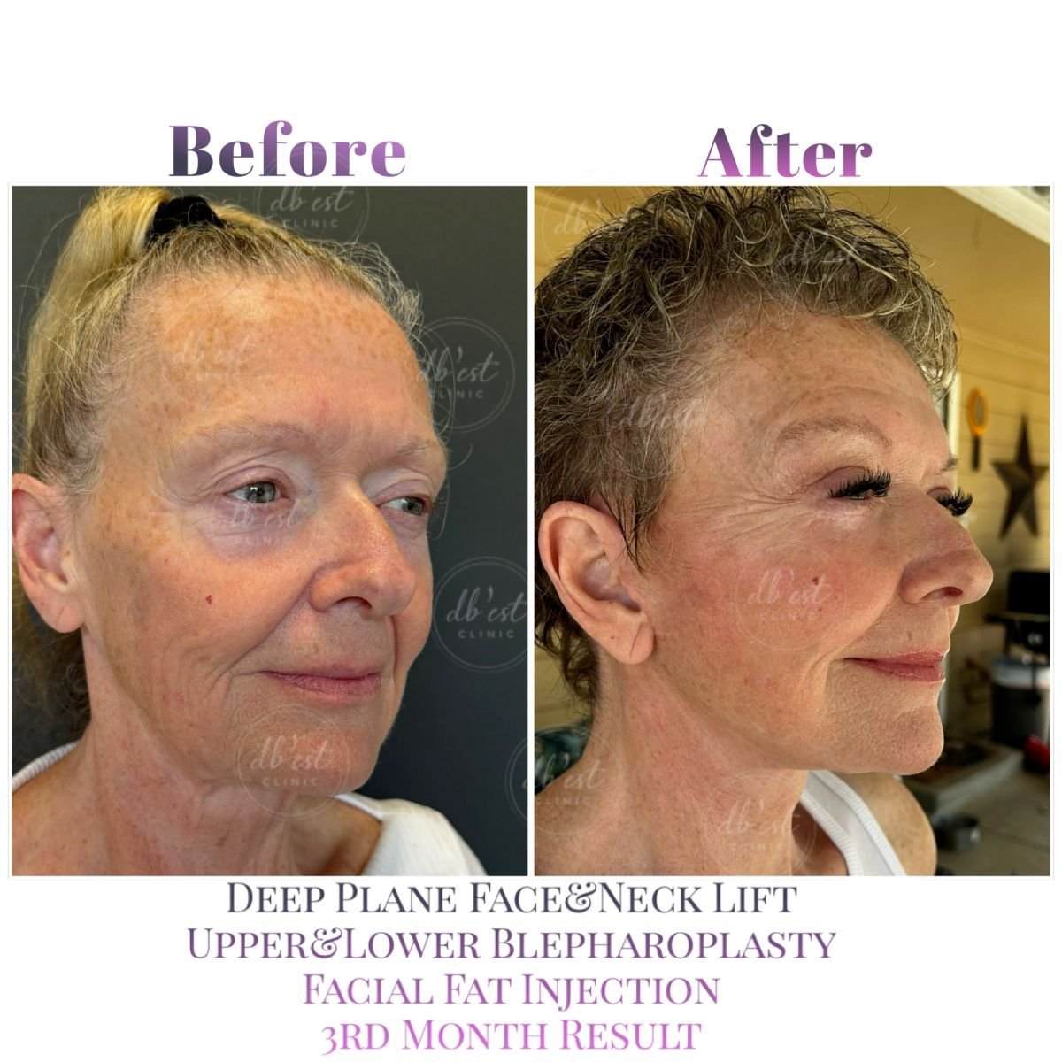 Clínica de Cirugía Plástica Estética y Reconstructiva Db'est Clinic