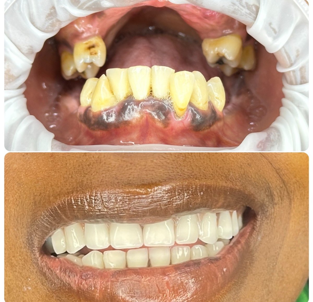 Love Dental & Sthetic Zahnklinik