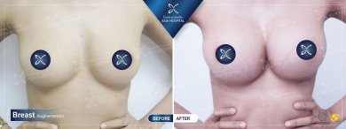 Asia Cosmetic Hospital