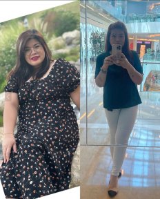 Before and after gastric balloon results at Dr. Islam Abdelkhalek's Clinic, visible weight loss