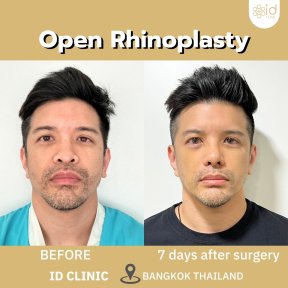 Клініка ID Clinic Bangkok