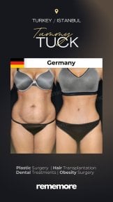 Memorial Sisli Hospital