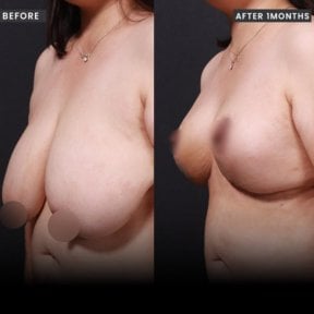 VG Plastic Surgery