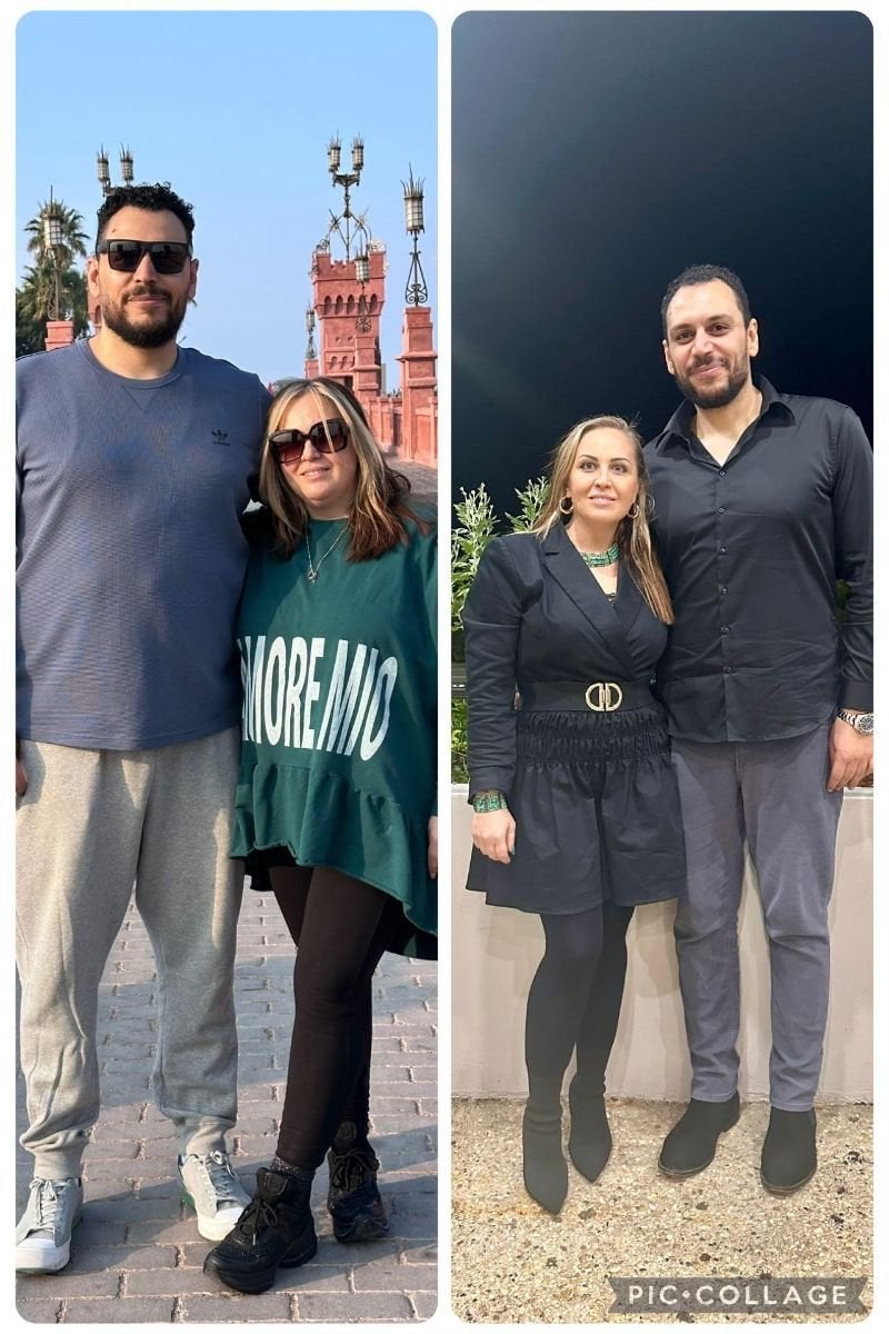 Resultados antes y después del balón gástrico en la clínica Dr. Islam Abdelkhalek, pérdida visible