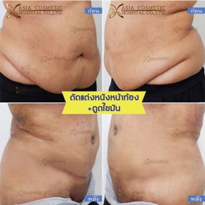 Asia Cosmetic Hospital