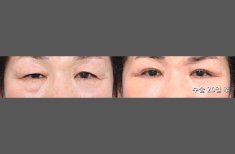 Photos avant et après par le Dr 