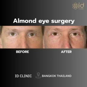 ID Clinic Bangkok
