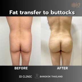 ID Clinic Bangkok