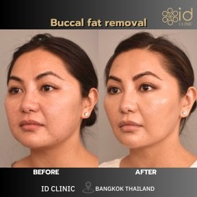 Клиника ID Clinic Bangkok