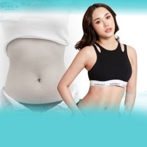 نتائج شفط الدهون 360 قبل وبعد في مستشفى وانسيري، تحسين واضح لتنسيق الجسم