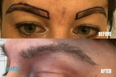 Клиника Quartz