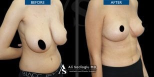 Photos avant et après par le Dr 