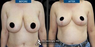 Photos avant et après par le Dr 