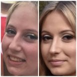 Photos avant et après par le Dr 