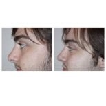 Photos avant et après par le Dr 