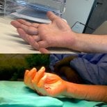 Фото до та після реконструктивної пластичної операції, доктор 