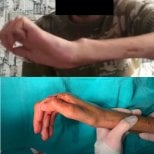 Фото до та після реконструктивної пластичної операції, доктор 