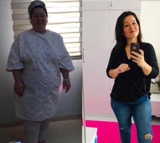 Résultats avant et après bypass gastrique à Assoc.Prof.Dr.Cemal Kara / Medical Park İzmir Hospital