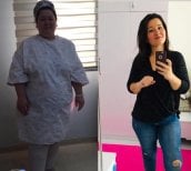 Résultats avant et après bypass gastrique à Assoc.Prof.Dr.Cemal Kara / Medical Park İzmir Hospital