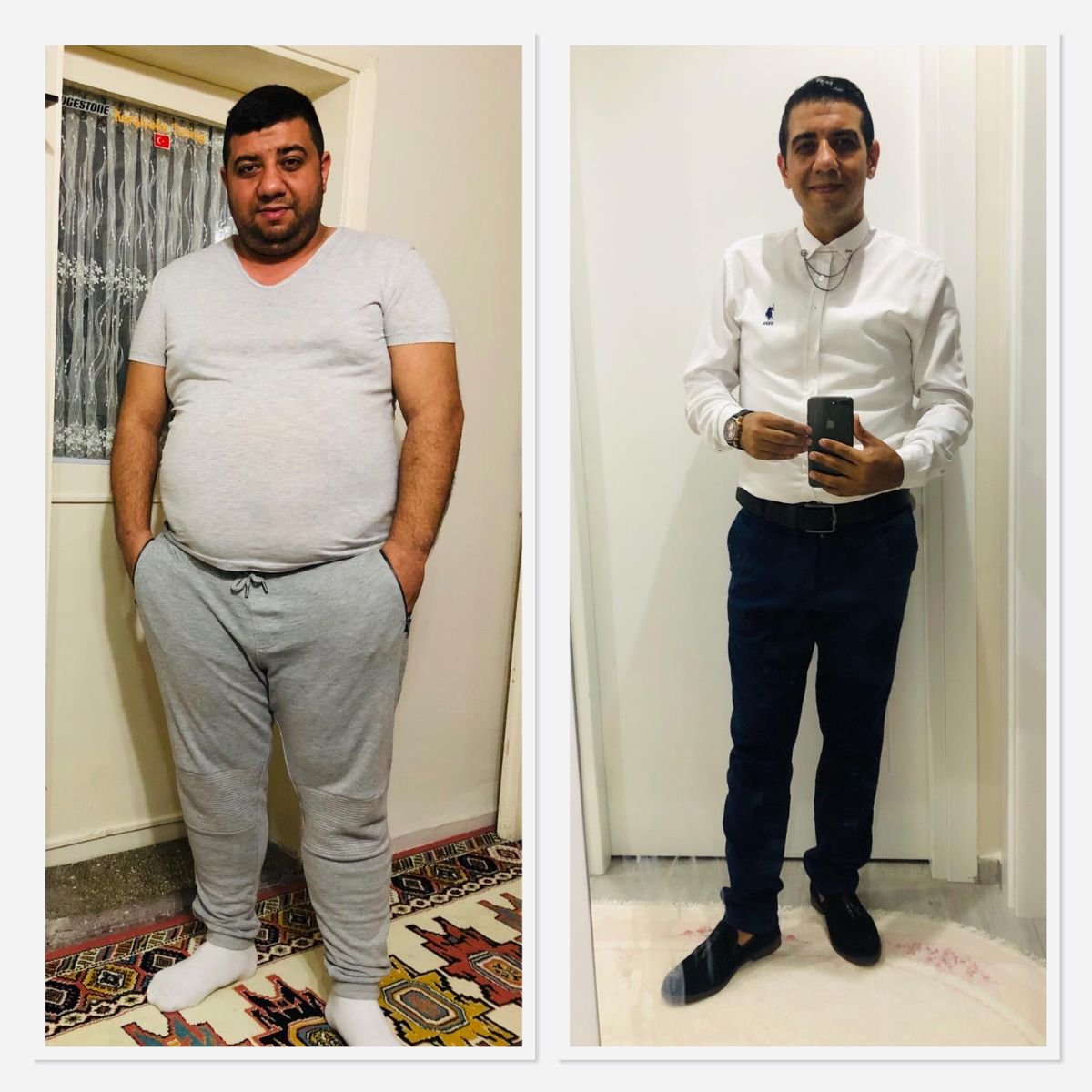 نتائج قبل وبعد جراحة تحويل مسار المعدة في Assoc.Prof.Dr.Cemal Kara / Medical Park İzmir Hospital