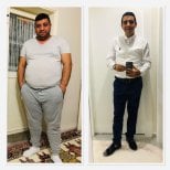 Résultats avant/après bypass gastrique chez Assoc.Prof.Dr.Cemal Kara / Medical Park İzmir Hospital