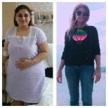 Résultats avant et après bypass gastrique à Assoc.Prof.Dr.Cemal Kara / Medical Park İzmir Hospital