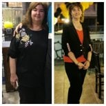 Résultats avant/après bypass gastrique chez Assoc.Prof.Dr.Cemal Kara / Medical Park İzmir Hospital