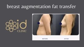 Фото до та після ліпосакції, доктор 