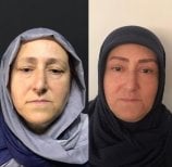 Before and after brow lift results at Hisar Hospital Intercontinental, rejuvenated eye area