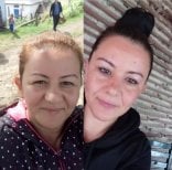 Before and after brow lift results at Hisar Hospital Intercontinental, rejuvenated eye area