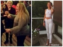 Результати до і після рукавної гастректомії Da Vinci у Hisar Hospital Intercontinental