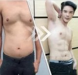 Фото до и после Vaser-липосакции, доктор 