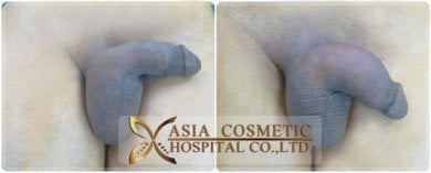 Asia Cosmetic Hospital