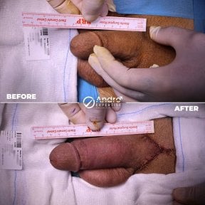 Andro Expertise Men's Health and Aesthetics