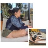 Before and after gastric bypass results at Dr. Enrique Pliego Private Practice, visible weight loss