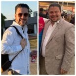 Before and after gastric bypass at Dr. Enrique Pliego Private Practice, visible weight loss result
