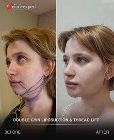 Клініка ClinicExpert