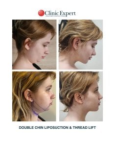 Клініка ClinicExpert